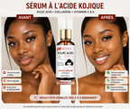 sérum collagène acide kogique